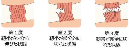 損傷の程度を正確に評価