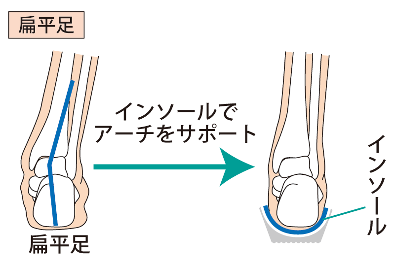 再発予防・セルフケア指導