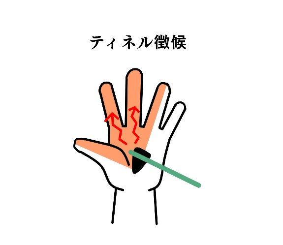 神経症状の状態をしっかり評価