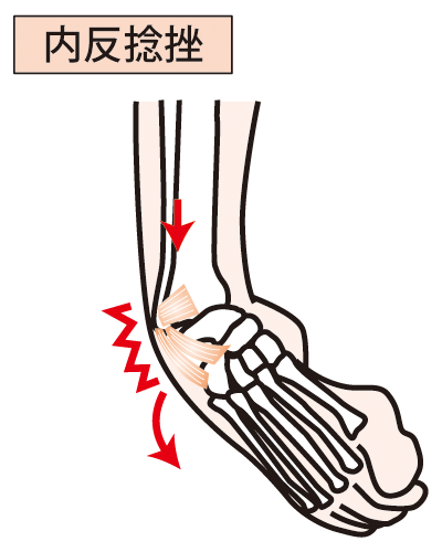 こんな場面で起こりやすい