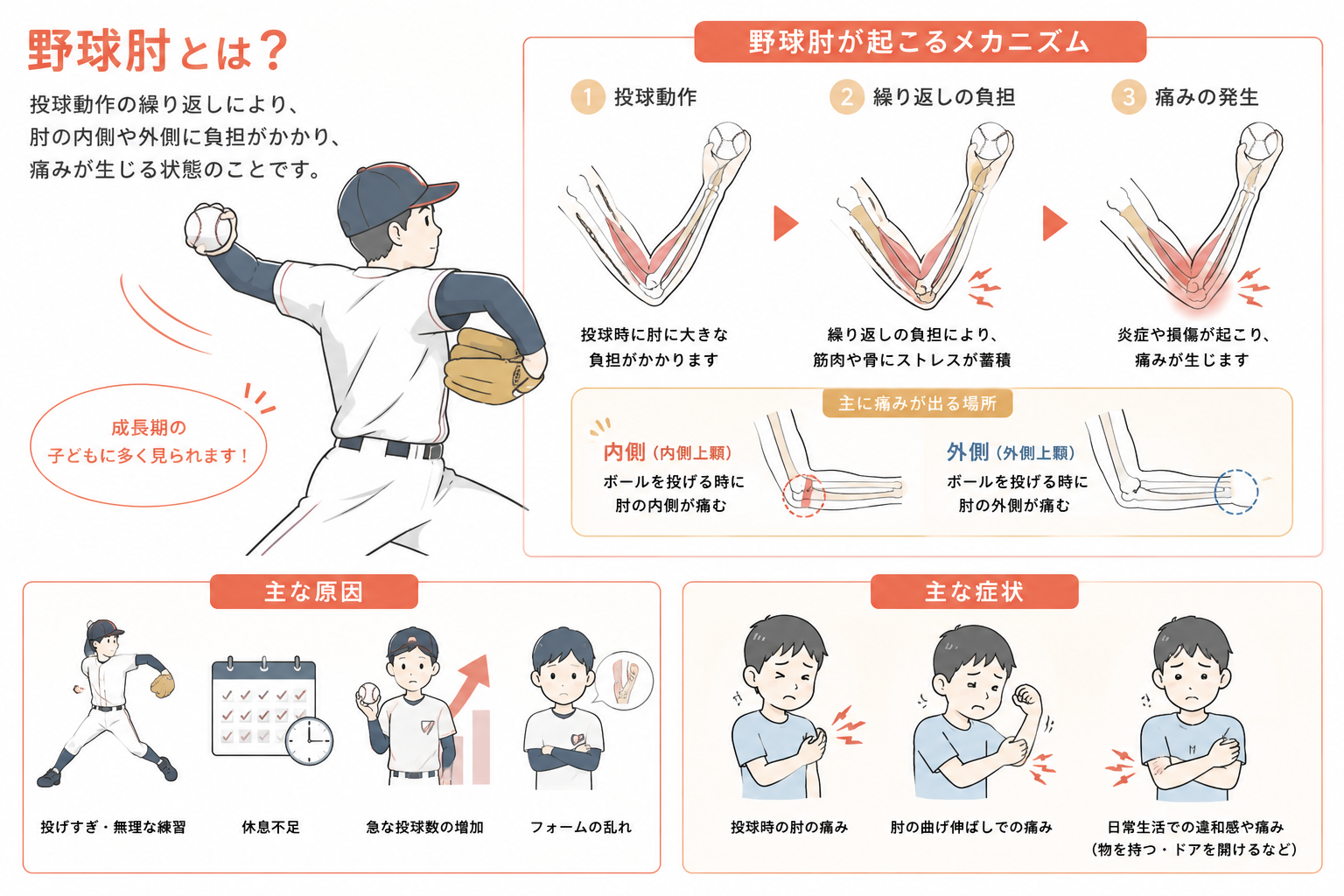 野球肘の原因と痛む部位