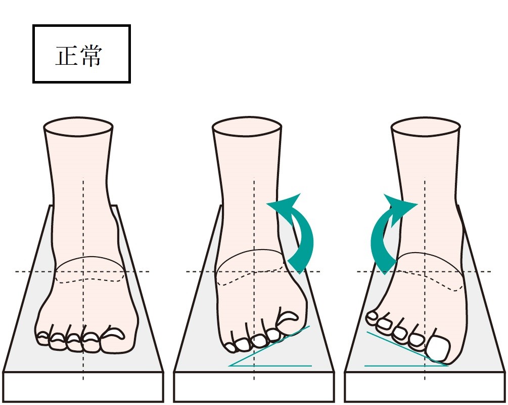 鵞足炎（がそくえん）の施術と再発予防