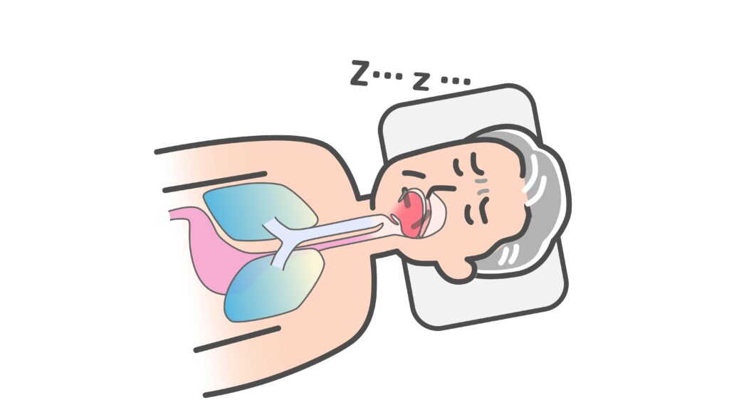 睡眠時無呼吸症候群とは？いびきや日中の眠気に注意