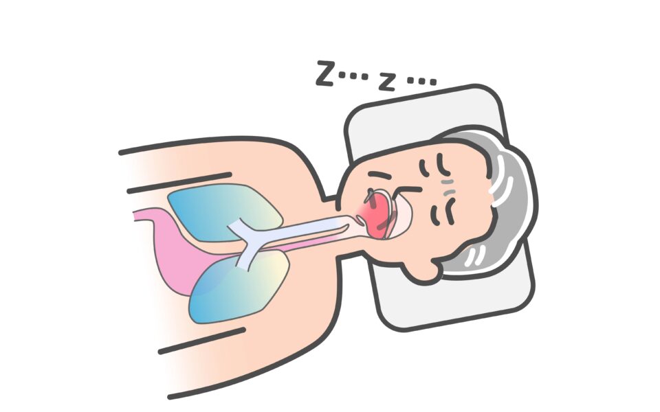 睡眠時無呼吸症候群とは？いびきや日中の眠気に注意